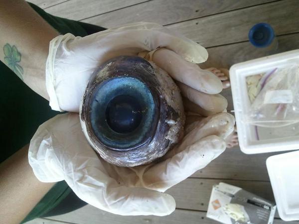 Eyeball